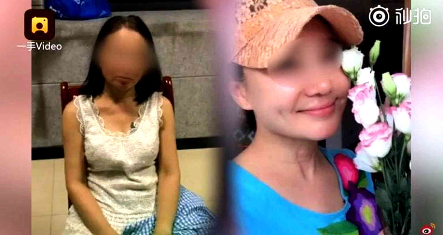 Elderly Woman Gets Plastic Surgery to Look 20 to Escape Creditors