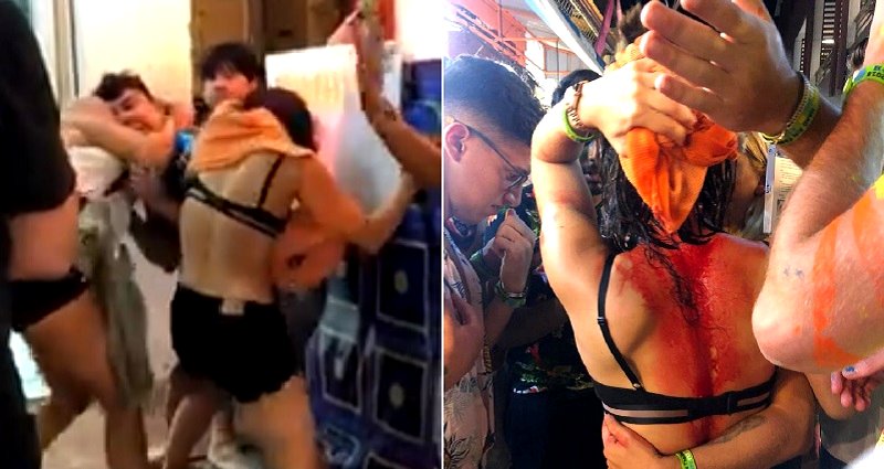 Female Tourist in Thailand Brutally A‌tta‌ck‌e‌d With a Bottle During Full Moon Festival Party