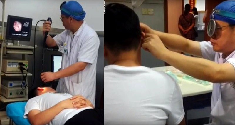Woman in China Ruptures Boyfriend’s Eardrum After Kissing Him Too Hard