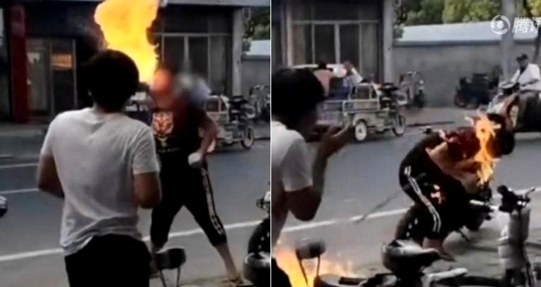 Teen Accidentally Sets His Face on Fire After Trying to Impress His Friends