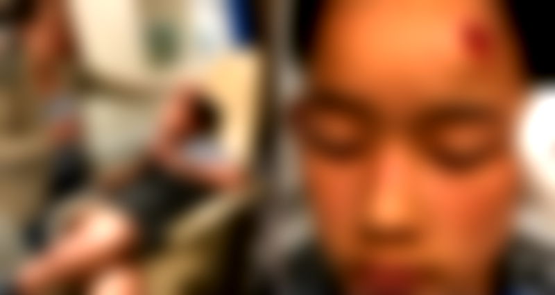 Family Sues School District, Class Bullies After Student Left Hospitalized in Palos Verdes