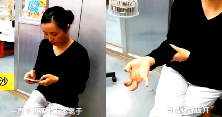 Woman’s Hand Disfigured After Using Phone Non-Stop For a Week