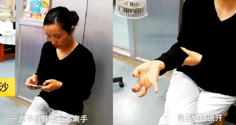 Woman’s Hand Disfigured After Using Phone Non-Stop For a Week