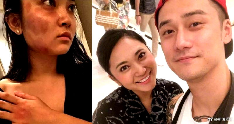 Japanese Model Claims Chinese Actor Ex-Boyfriend K‌ic‌ke‌d Her Stomach Until She Mi‌sca‌rri‌ed