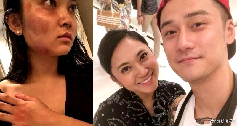 Japanese Model Claims Chinese Actor Ex-Boyfriend K‌ic‌ke‌d Her Stomach Until She Mi‌sca‌rri‌ed