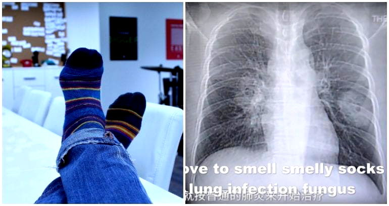 Chinese Man Obsessed With Sniffing His Socks After Work Gets Fungal Infection in His Lungs