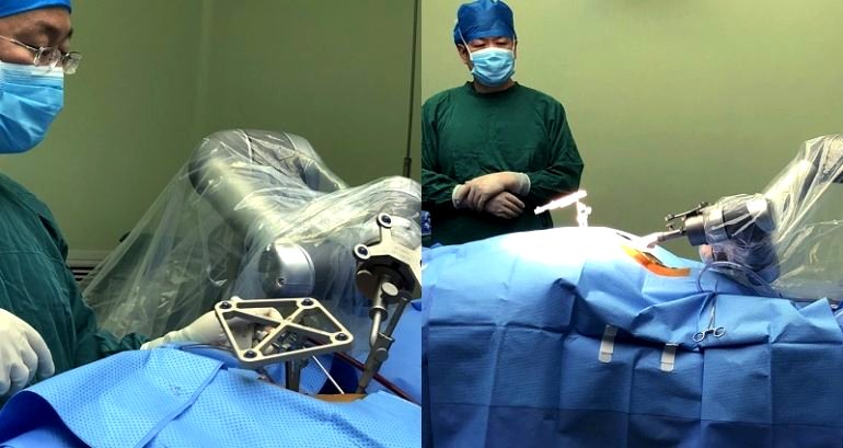 China Just Completed Its First Successful Robotic Surgery