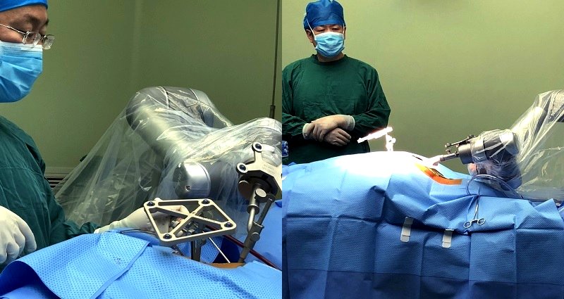 China Just Completed Its First Successful Robotic Surgery