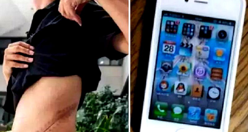 Chinese Man Now Faces Serious Organ Failure After Selling Kidney For iPhone 4 in 2011