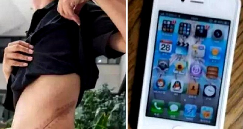 Chinese Man Now Faces Serious Organ Failure After Selling Kidney For iPhone 4 in 2011