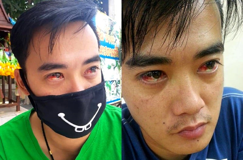 Images of Bangkok residents allegedly coughing up blood and suffering nosebleeds due to the city's pollution crisis have emerged on social media.