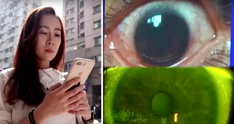 Taiwanese Woman B‌u‌r‌ns 500 Holes in Her Eyes After Using Phone on Max Brightness For Two Years