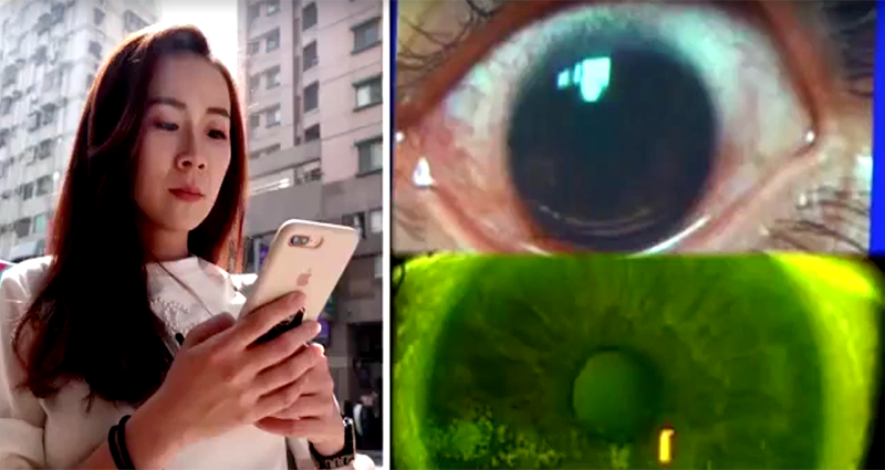 Taiwanese Woman B‌u‌r‌ns 500 Holes in Her Eyes After Using Phone on Max  Brightness For Two Years