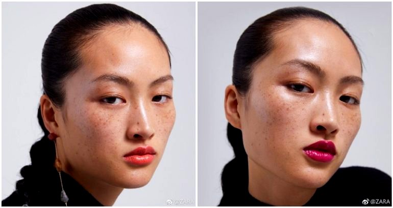 Zara Accused of ‘Uglifying’ China After Using Model With Freckles