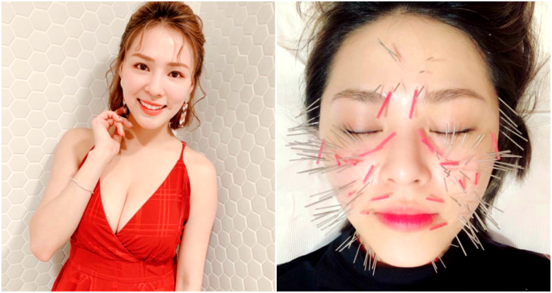 Taiwanese Models Sticks Hundreds of Needles in Her Face to Maker it ‘Smaller’
