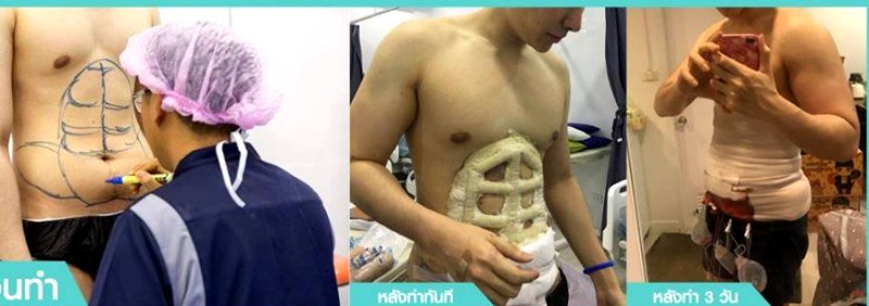 Thailand has finally brought us into the future by making it possible to achieve six-pack abs without the heavy gym workouts and strict diets.