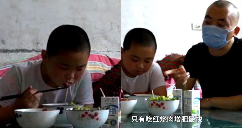 Chinese Boy Gains 30 Pounds Stuffing Himself With Food to Donate Bone Marrow to Dad