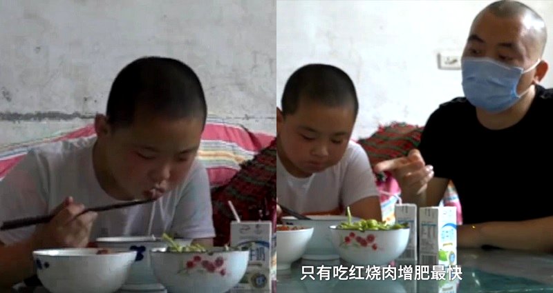 Chinese Boy Gains 30 Pounds Stuffing Himself With Food to Donate Bone Marrow to Dad