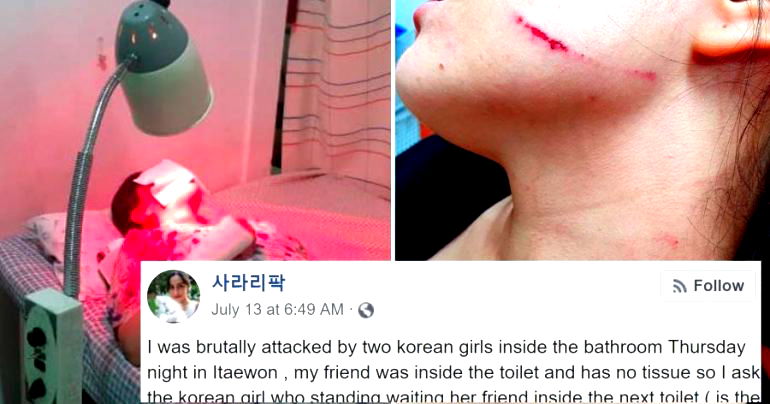 Swedish Woman Claims Korean Girls Brutally Beat Her After Asking Them For a Tissue