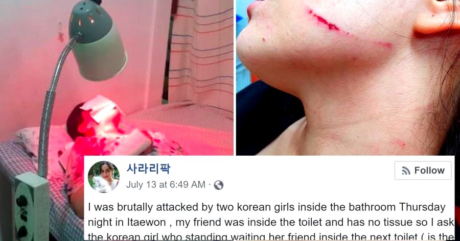 Swedish Woman Claims Korean Girls Brutally Beat Her After Asking Them For a Tissue