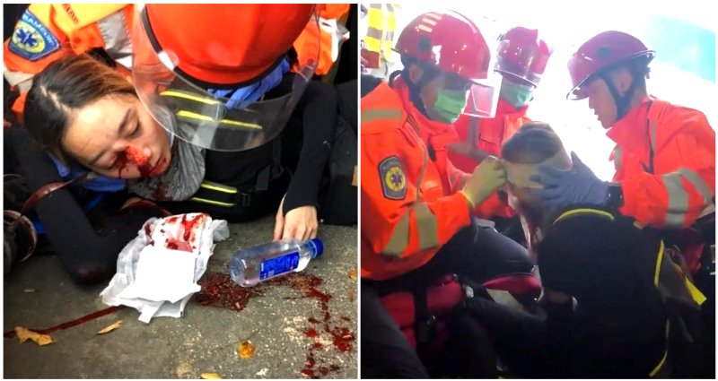 HK Police Fire Bean Bag at Protester’s Face, Ripping Woman’s Eyeball Open