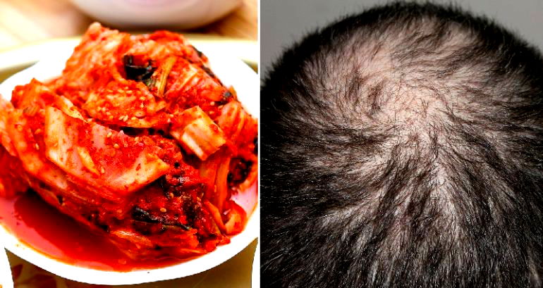 Kimchi Juice Has Been Found to Reverse Hair Loss, Scientists Claim