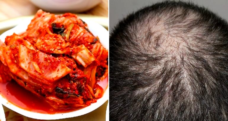 Kimchi Juice Has Been Found to Reverse Hair Loss, Scientists Claim