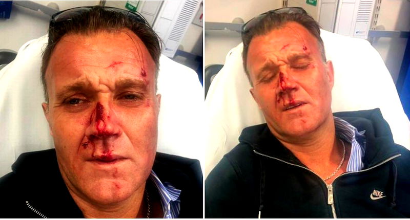Man Brutally Beaten for Defending Asian Boy From ‘Racist Attack’