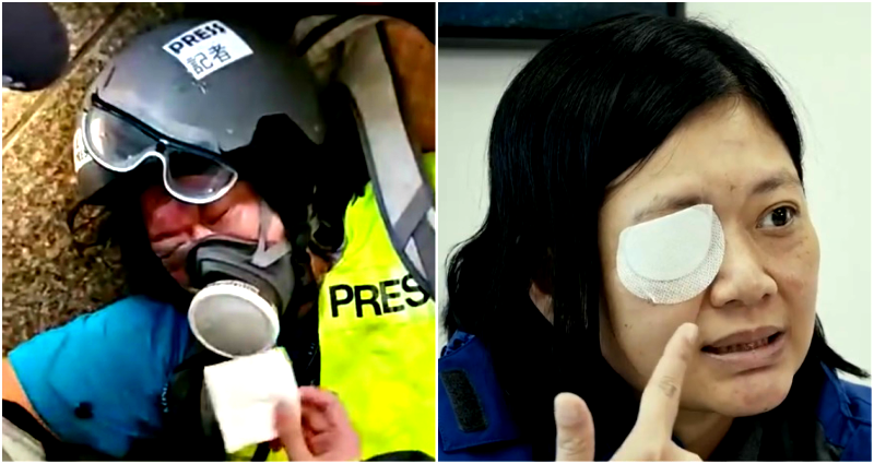 Indonesian Journalist Who Lost Her Eye in Protests is Now Suing the HK ...