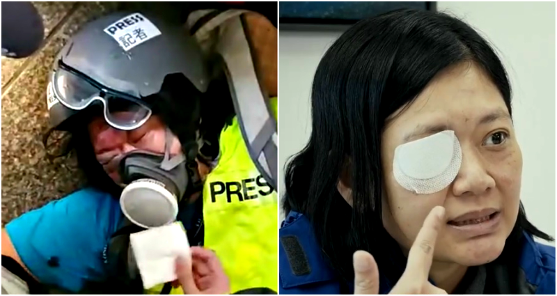 Indonesian Journalist Who Lost Her Eye in Protests is Now Suing the HK Police