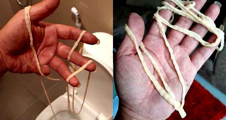 Thai Man Pulls 32-Foot Long Tapeworm From His Butt After Going to the Bathroom