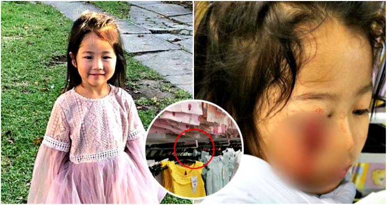6-Year-Old Girl Scarred for Life After Losing Her EYELID in Freak Shopping Accident