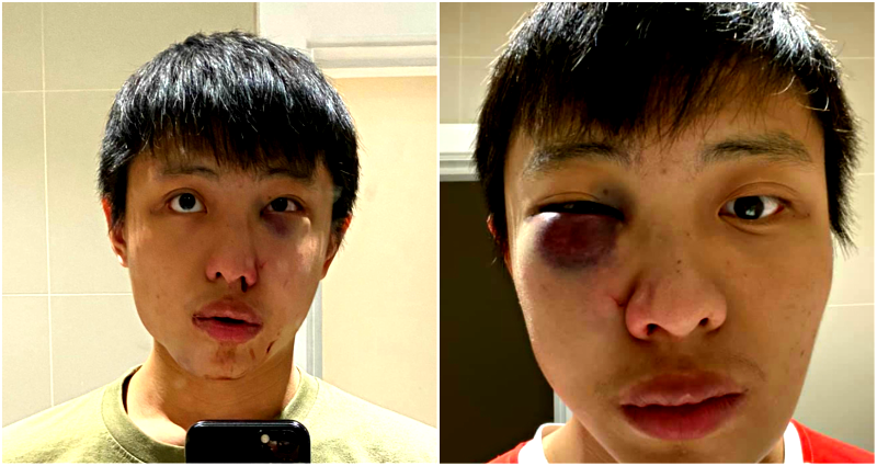 U.K. Teen Found Guilty of Racist ‘Coronavirus’ Attack on Singaporean Student