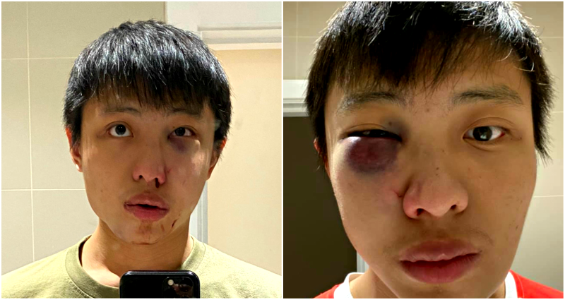 Singaporean Student Brutally Attacked By Group for ‘Spreading Coronavirus’ in London
