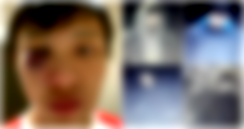 Suspects Who Attacked Singaporean Student in Coronavirus Panic in London Revealed