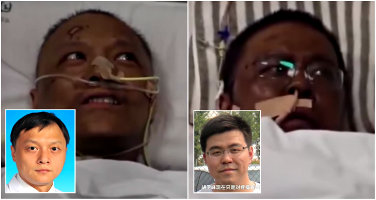 Chinese Doctors Wake Up With ‘Dark Skin’ After Recovering From COVID-19