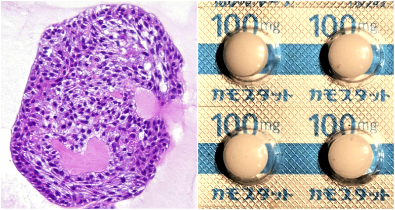 Japan Grows Mini Bronchi to Test COVID-19 Drug