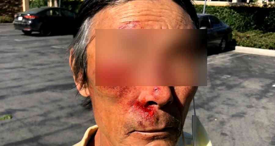 UPDATE: Elderly Korean Man Attacked While Waiting for Bus, Suspect Fled on Foot