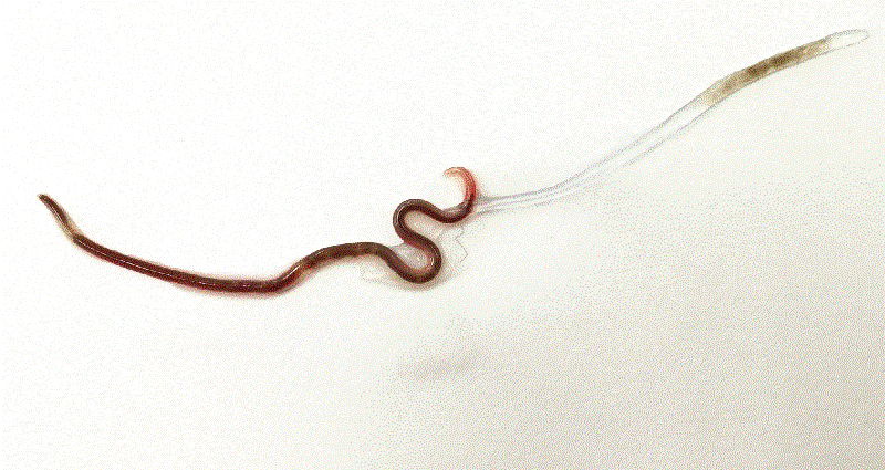 Japanese Doctors Pull Out 1.5-Inch Worm From Woman’s Tonsils After Eating Sashimi