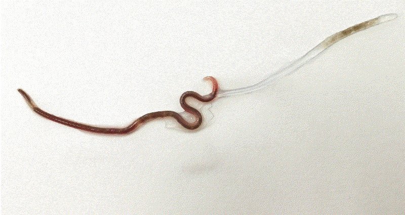 Japanese Doctors Pull Out 1.5-Inch Worm From Woman’s Tonsils After Eating Sashimi