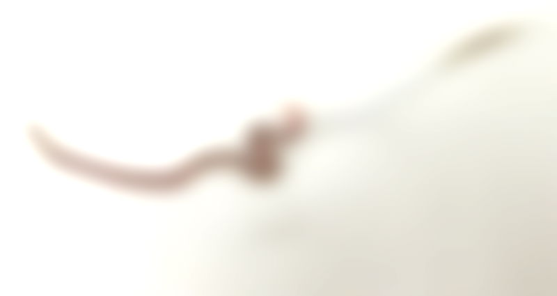 Japanese Doctors Pull Out 1.5-Inch Worm From Woman’s Tonsils After Eating Sashimi