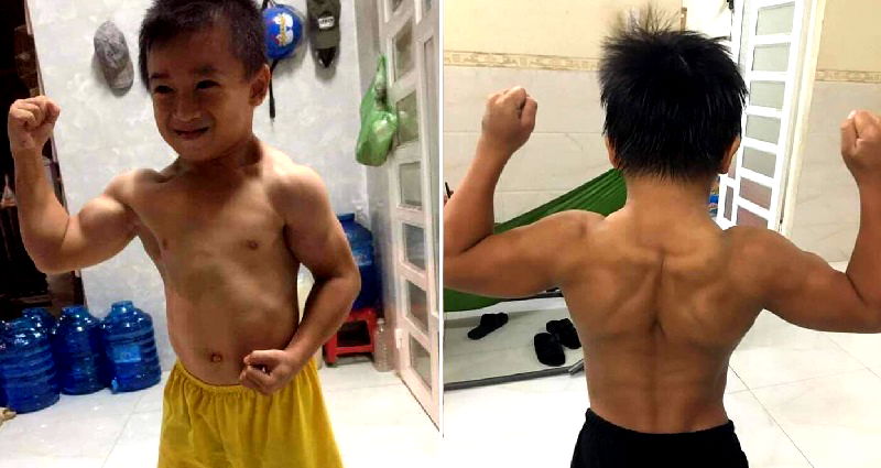 Vietnamese Boy’s Rare Condition Makes Him Ripped