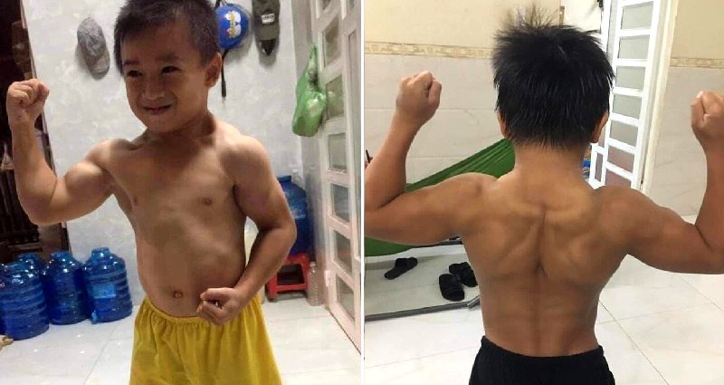 Vietnamese Boy’s Rare Condition Makes Him Ripped