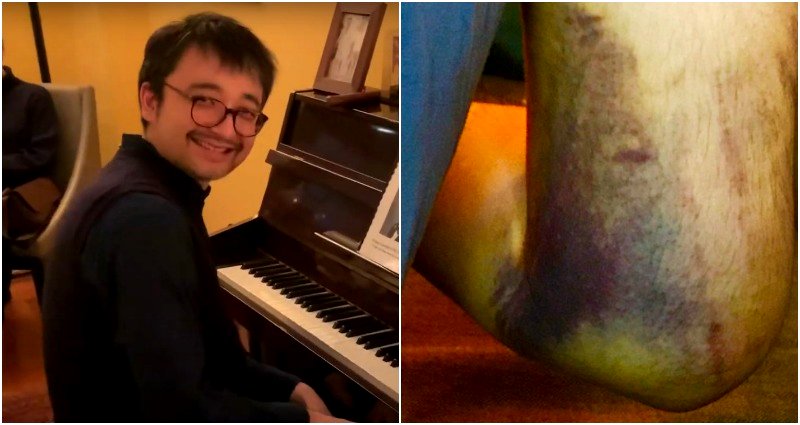 Japanese Musician Beaten By Teens in NYC Who Thought He Was Chinese