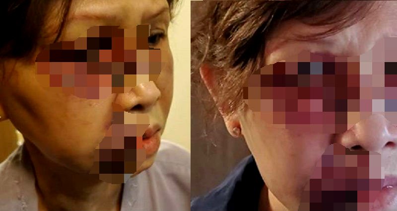 Vietnamese Mother Brutally Beaten in San Francisco