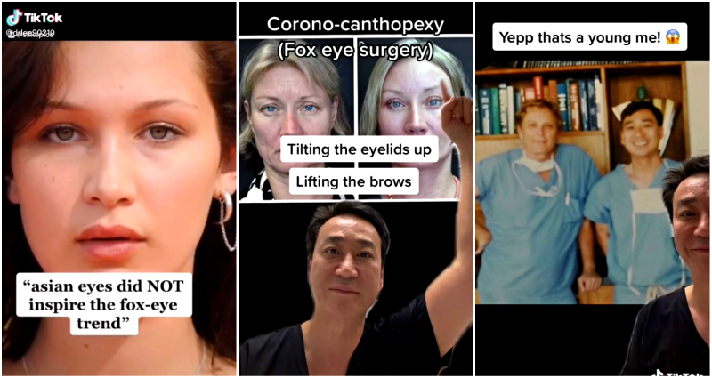 Plastic Surgeon Proves ‘Fox Eye’ Trend Was Sparked By Asian Features on TikTok