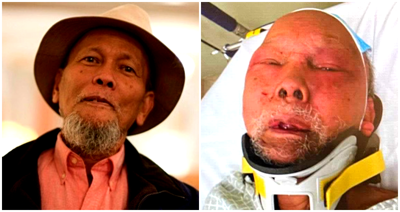 Philadelphia Man, 83, in ICU After Being Brutally Beaten and Robbed on New Year’s Eve