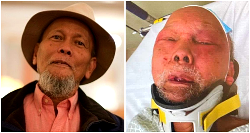 Philadelphia Man, 83, in ICU After Being Brutally Beaten and Robbed on New Year’s Eve