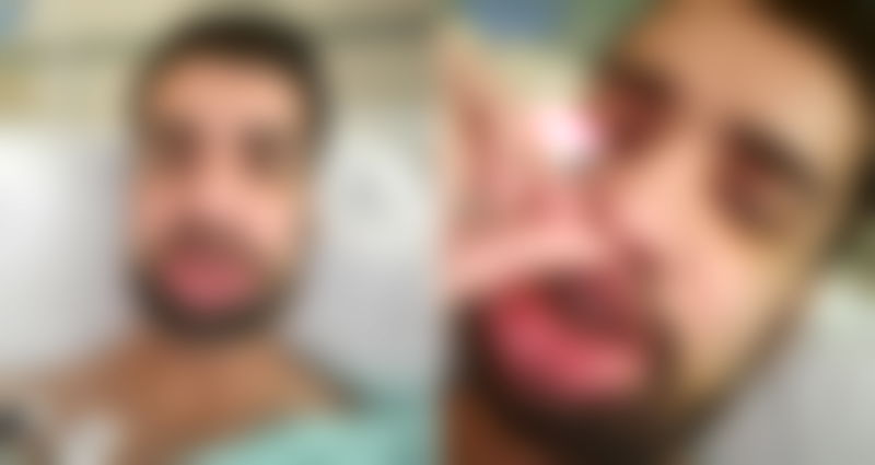 Man’s Face is Broken in ‘Hate Attack’ Near Sacramento