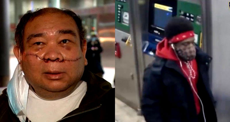 Man’s Face Slashed After NYC Subway Argument, Police Search for Suspect